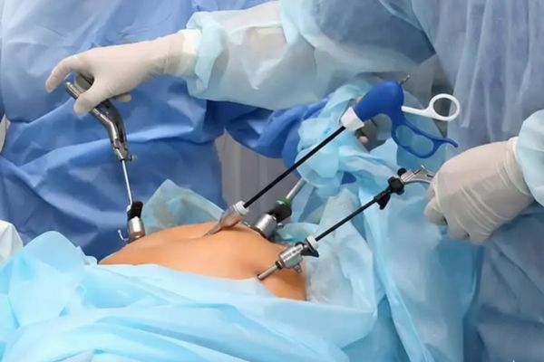 Laparoscopic Gynecology
