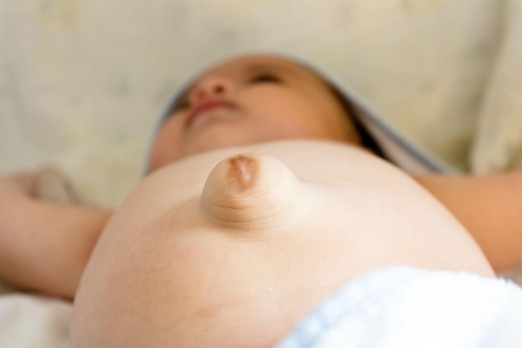 Hernia Treatment for Kids in Bengaluru
