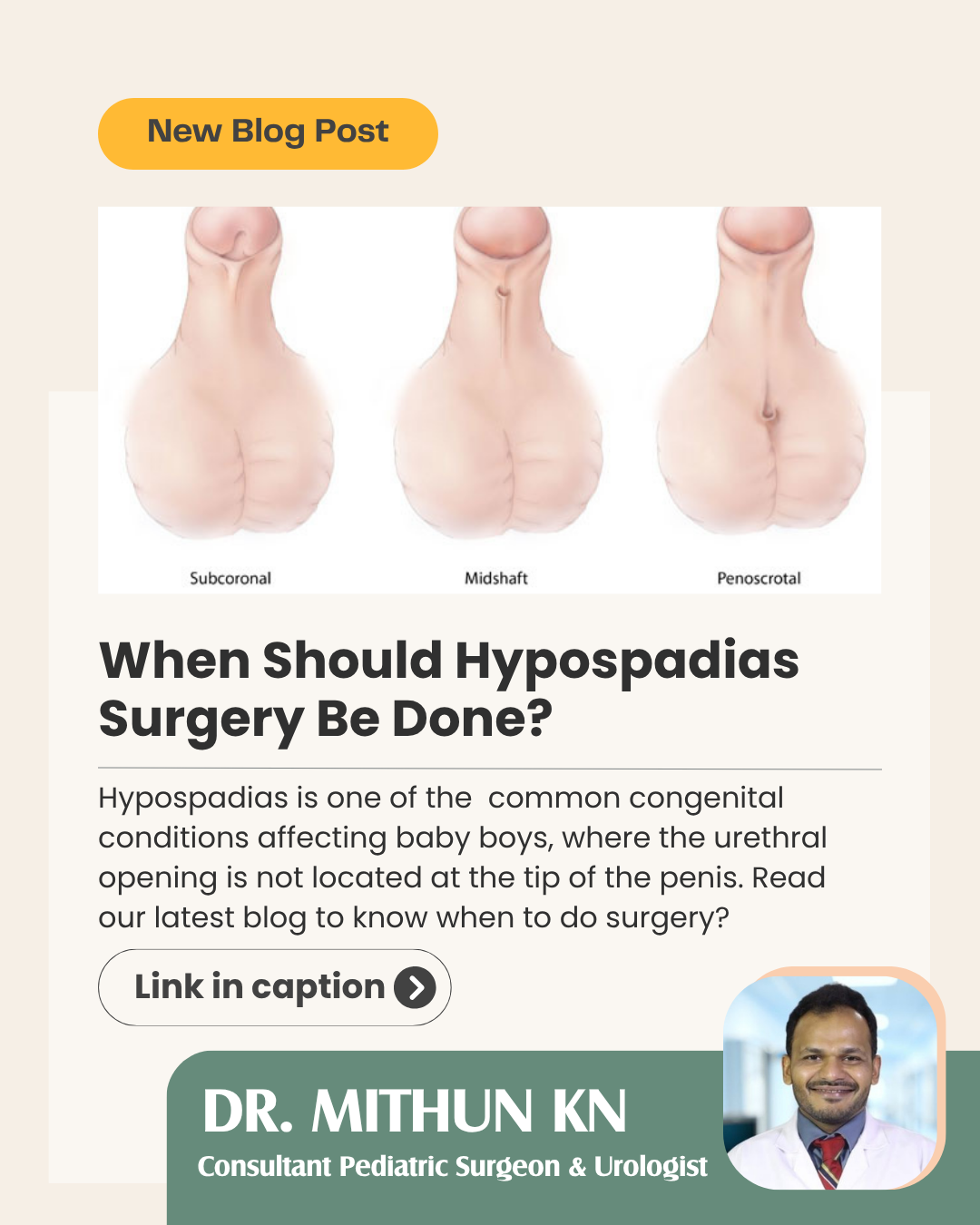 Hypospadias Treatment in Bengaluru