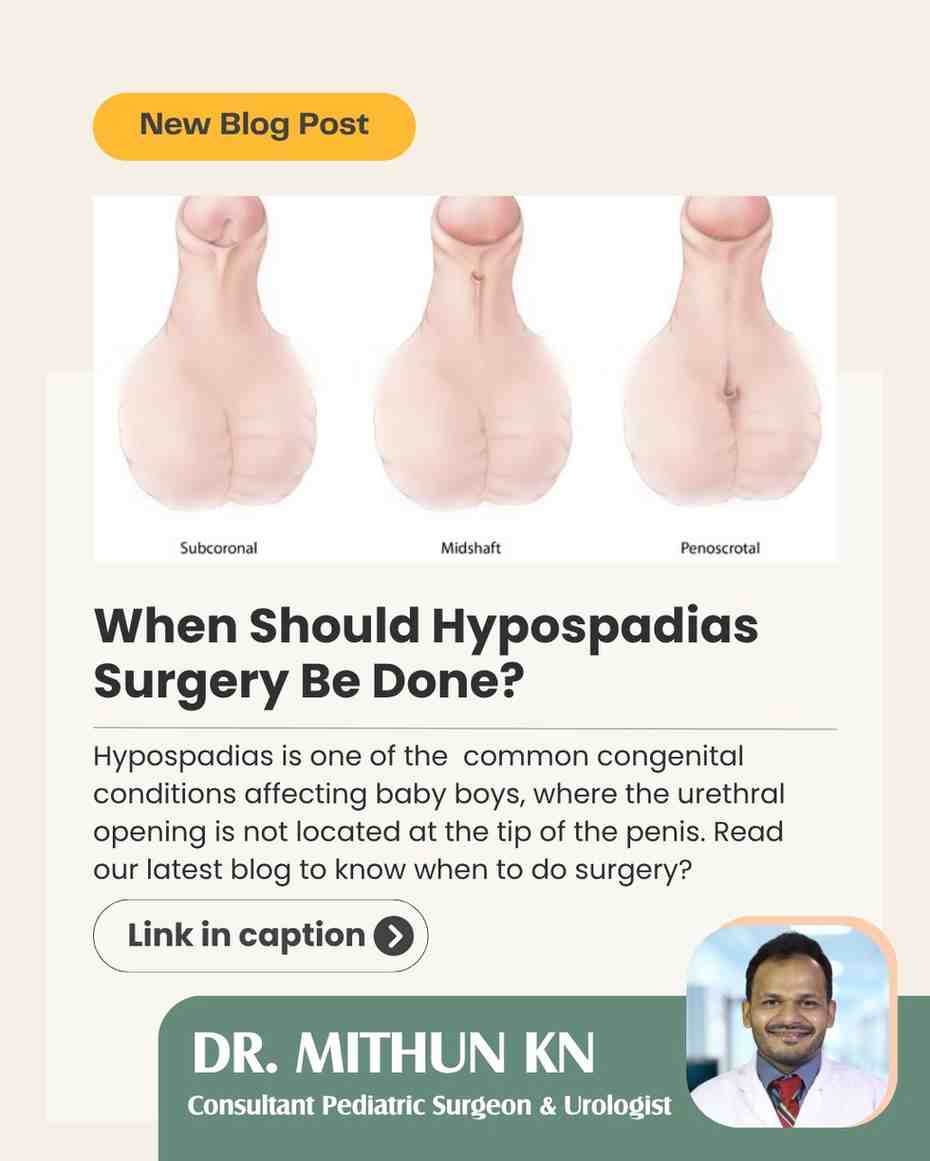 Hypospadias Treatment in Bengalur - Dr Mithun KN